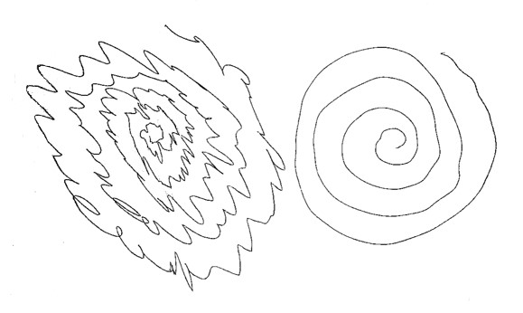 Spiral drawing test of an essential-tremor patient